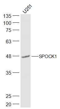 Fig1: Sample:; U251(Human) Cell Lysate at 30 ug; Primary: Anti-SPOCK1 at 1/500 dilution; Secondary: IRDye800CW Goat Anti-Rabbit IgG at 1/20000 dilution; Predicted band size: 49 kD; Observed band size: 48 kD