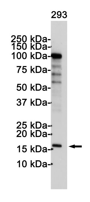 Western blot detection of p16 INK4A in 293 cell lysates using p16 INK4A Rabbit pAb(1:1000 diluted).Predicted band size:17KDa.Observed band size:17KDa.