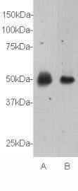 Fig1: Western blot analysis on mouse spinal cord (A) and mouse brain (B) using anti- Relaxin 3 receptor 1 polyclonal antibody.