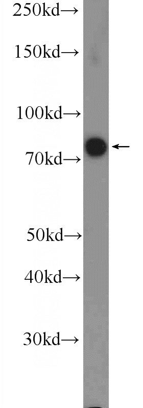 HeLa cells were subjected to SDS PAGE followed by western blot with Catalog No:114926(RRN3 Antibody) at dilution of 1:600