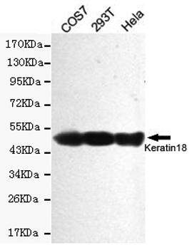 Western blot detection of Keratin 18 in Hela,COS7 and 293T cell lysates using Keratin 18 mouse mAb (1:2000 diluted).Predicted band size:46KDa.Observed band size:46KDa.