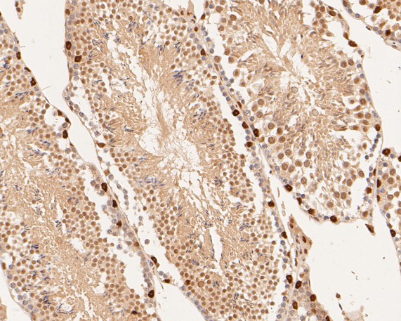 Fig4: Immunohistochemical analysis of paraffin-embedded mouse testis tissue using anti-Dux antibody. The section was pre-treated using heat mediated antigen retrieval with sodium citrate buffer (pH 6.0) for 20 minutes. The tissues were blocked in 5% BSA for 30 minutes at room temperature, washed with ddH2O and PBS, and then probed with the primary antibody ( 1/200) for 30 minutes at room temperature. The detection was performed using an HRP conjugated compact polymer system. DAB was used as the chromogen. Tissues were counterstained with hematoxylin and mounted with DPX.
