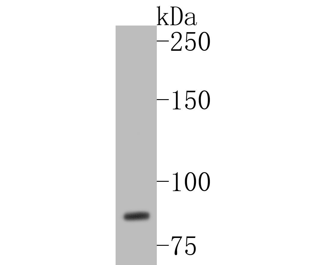 Fig1:; Western blot analysis of WDR70 on Hela cell lysates. Proteins were transferred to a PVDF membrane and blocked with 5% BSA in PBS for 1 hour at room temperature. The primary antibody ( 1/500) was used in 5% BSA at room temperature for 2 hours. Goat Anti-Rabbit IgG - HRP Secondary Antibody (HA1001) at 1:5,000 dilution was used for 1 hour at room temperature.