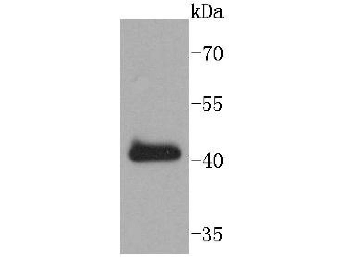 Fig1:; Western blot analysis of SOX18 on K562 cell lysates. Proteins were transferred to a PVDF membrane and blocked with 5% BSA in PBS for 1 hour at room temperature. The primary antibody ( 1/500) was used in 5% BSA at room temperature for 2 hours. Goat Anti-Rabbit IgG - HRP Secondary Antibody (HA1001) at 1:200,000 dilution was used for 1 hour at room temperature.