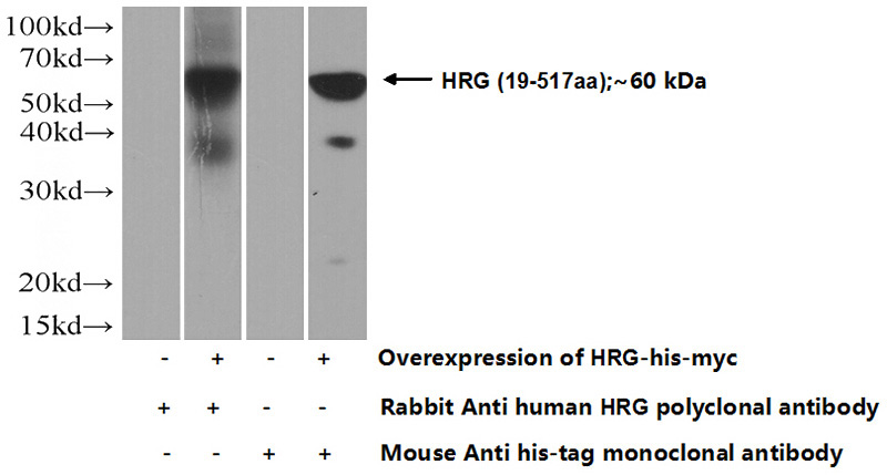 Transfected HEK-293 cells were subjected to SDS PAGE followed by western blot with Catalog No:111462(HRG Antibody) at dilution of 1:1000