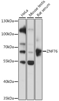 Western blot - ZNF76 Polyclonal Antibody 