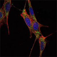 Immunofluorescence analysis of NIH/3T3 cells using SMAD4 mouse mAb (green). Blue: DRAQ5 fluorescent DNA dye. Red: Actin filaments have been labeled with Alexa Fluor-555 phalloidin.