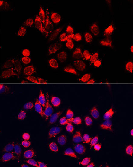 Immunofluorescence - NFE2L1 Polyclonal Antibody 