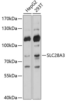 Western blot - SLC28A3 Polyclonal Antibody 