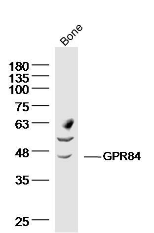 Fig2: Sample: bone (Rat) Lysate at 40 ug; Primary: Anti- GPR84 at 1/300 dilution; Secondary: IRDye800CW Goat Anti-Rabbit IgG at 1/20000 dilution; Predicted band size: 44kD; Observed band size: 44 kD