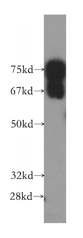 HeLa cells were subjected to SDS PAGE followed by western blot with Catalog No:114868(RUFY1 antibody) at dilution of 1:1000