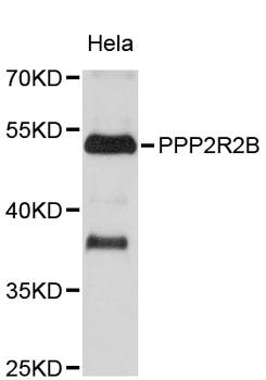 Western blot - PPP2R2B Polyclonal Antibody 