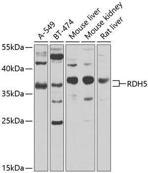Western blot - RDH5 Polyclonal Antibody 