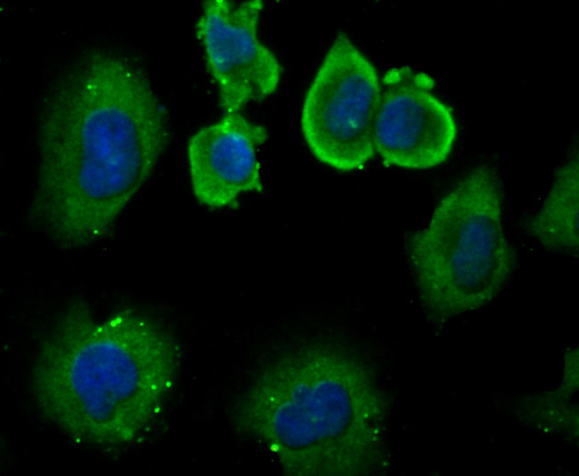 Fig3: ICC staining DLL4 in HUVEC cells (green). The nuclear counter stain is DAPI (blue). Cells were fixed in paraformaldehyde, permeabilised with 0.25% Triton X100/PBS.