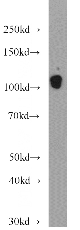 mouse heart tissue were subjected to SDS PAGE followed by western blot with Catalog No:108772(CDH13 antibody) at dilution of 1:1000