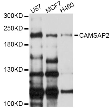 Western blot - CAMSAP2 Polyclonal Antibody 