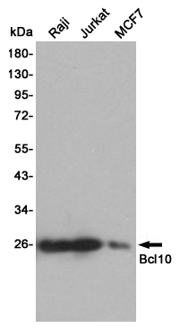 Western blot detection of Bcl10 in Raj,Jurkat and MCF7 cell lysates using Bcl10 mouse mAb (1:1000 diluted).Predicted band size:26KDa.Observed band size:26KDa.
