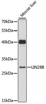 Western blot - LIN28B Polyclonal Antibody 