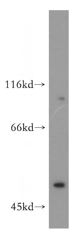 mouse testis tissue were subjected to SDS PAGE followed by western blot with Catalog No:110133(dynactin-2 antibody) at dilution of 1:800