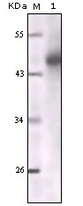 Western blot analysis using CK mouse mAb against truncated CK5 recombinant protein.