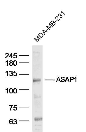 Fig1: Sample: MDA-MB-231 (human)cell Lysate at 40 ug; Primary: Anti- ASAP1 at 1/300 dilution; Secondary: IRDye800CW Goat Anti-Rabbit IgG at 1/20000 dilution; Predicted band size: 125kD; Observed band size: 125 kD