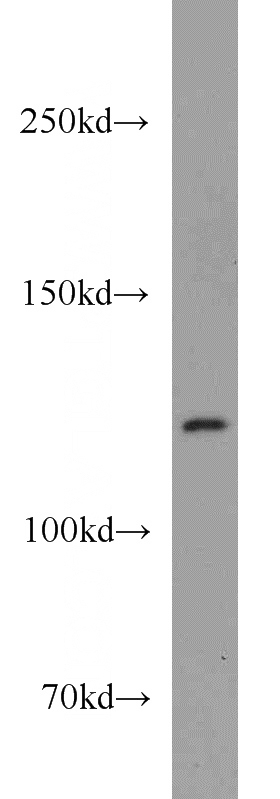 Jurkat cells were subjected to SDS PAGE followed by western blot with Catalog No:111616(IFIH1 antibody) at dilution of 1:1500