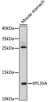 Western blot - RPL35A Polyclonal Antibody 