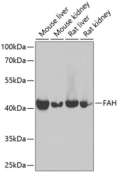 Western blot - FAH Polyclonal Antibody 