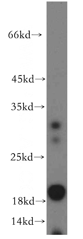 human liver tissue were subjected to SDS PAGE followed by western blot with Catalog No:108249(ARF6-Specific antibody) at dilution of 1:300