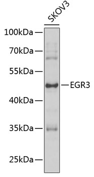 Western blot - EGR3 Polyclonal Antibody 
