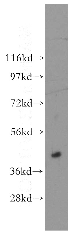 human brain tissue were subjected to SDS PAGE followed by western blot with Catalog No:107748(Loc344967 antibody) at dilution of 1:3000