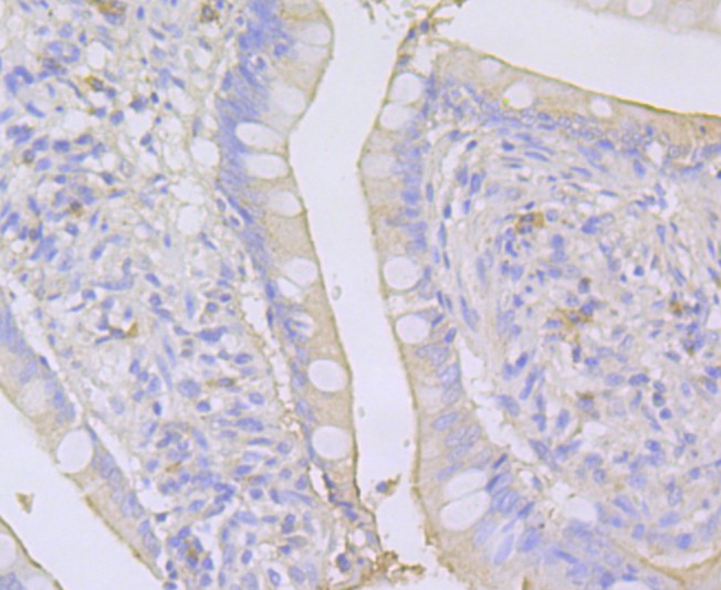 Fig3:; Immunohistochemical analysis of paraffin-embedded Human small intestine tissue using anti-SPATA5L1 antibody. The section was pre-treated using heat mediated antigen retrieval with Tris-EDTA buffer (pH 8.0-8.4) for 20 minutes.The tissues were blocked in 5% BSA for 30 minutes at room temperature, washed with ddH; 2; O and PBS, and then probed with the primary antibody ( 1/100) for 30 minutes at room temperature. The detection was performed using an HRP conjugated compact polymer system. DAB was used as the chromogen. Tissues were counterstained with hematoxylin and mounted with DPX.