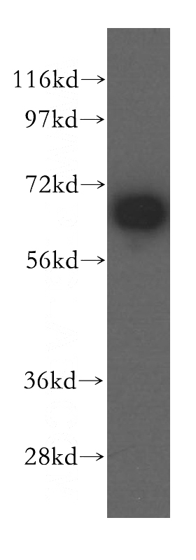 A431 cells were subjected to SDS PAGE followed by western blot with Catalog No:112391(MAGED2 antibody) at dilution of 1:1000