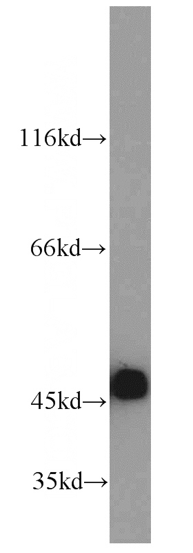 A431 cells were subjected to SDS PAGE followed by western blot with Catalog No:109800(KRT18 antibody) at dilution of 1:2000