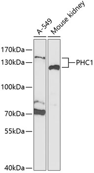 Western blot - PHC1 Polyclonal Antibody 
