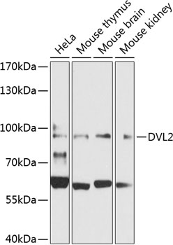Western blot - DVL2 Polyclonal Antibody 