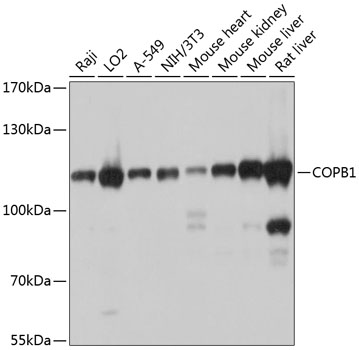 Western blot - COPB1 Polyclonal Antibody 