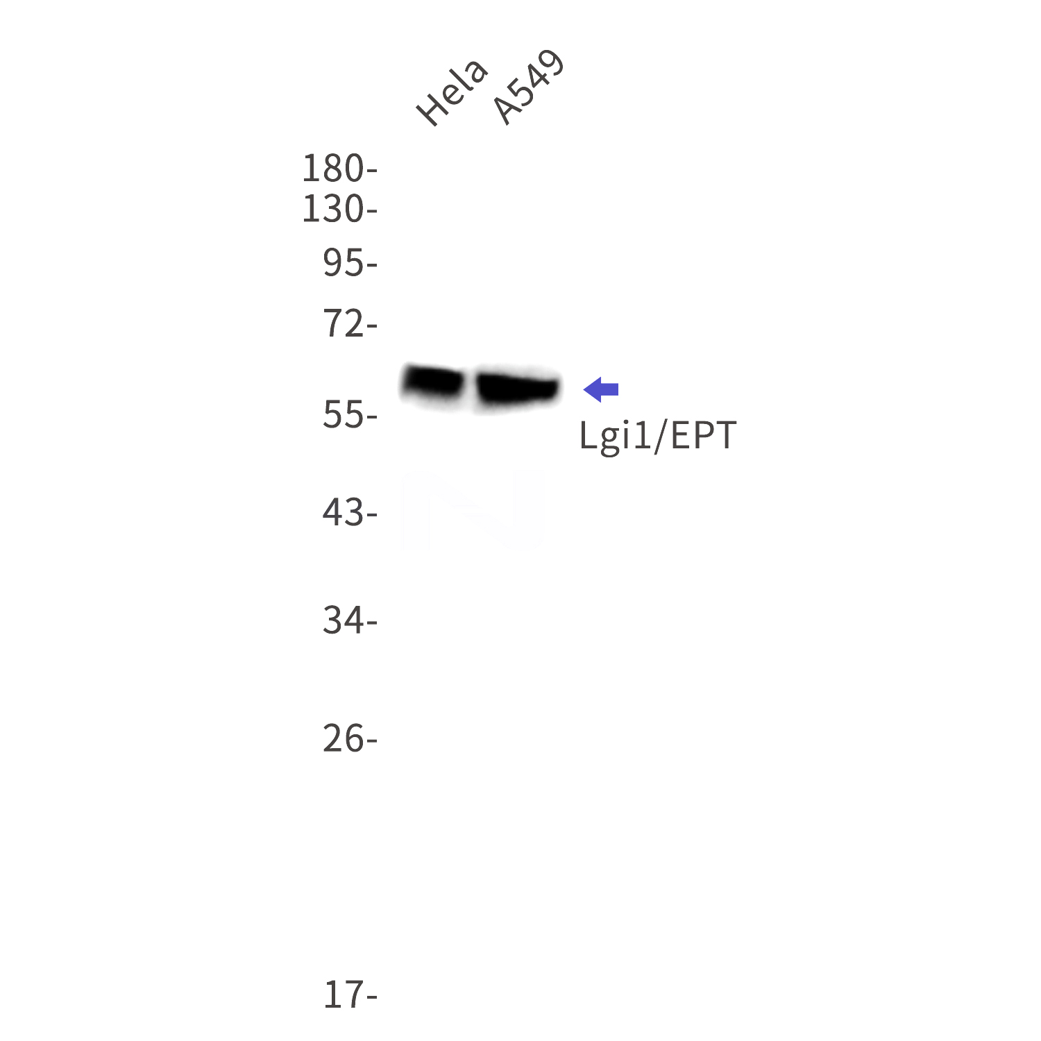 Western blot detection of Lgi1/EPT in Hela,A549 cell lysates using Lgi1/EPT Rabbit mAb(1:1000 diluted).Predicted band size:64kDa.Observed band size:64kDa.