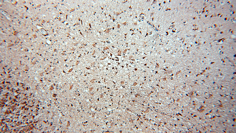 Immunohistochemical of paraffin-embedded human brain using Catalog No:112431(MAPK11 antibody) at dilution of 1:50 (under 10x lens)