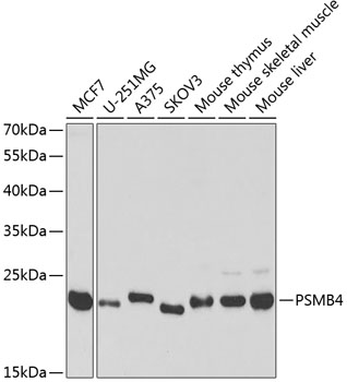 Western blot - PSMB4 Polyclonal Antibody 