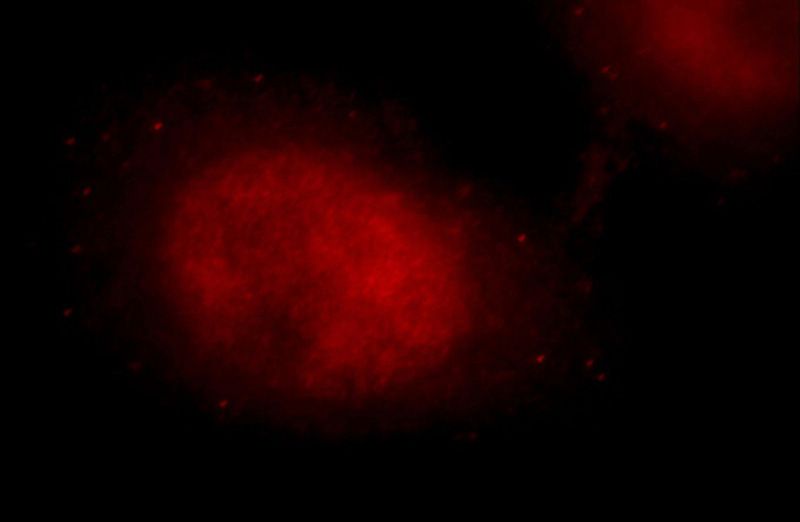 Immunofluorescent analysis of Hela cells, using DDX17 antibody Catalog No:109781 at 1:25 dilution and Rhodamine-labeled goat anti-rabbit IgG (red).