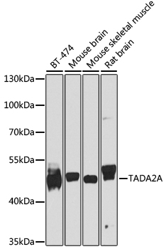 Western blot - TADA2A Polyclonal Antibody 