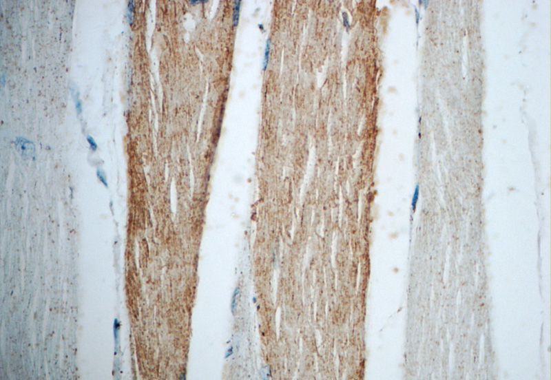 Immunohistochemistry of paraffin-embedded human skeletal muscle slide using Catalog No:113122(NEURL2 Antibody) at dilution of 1:50