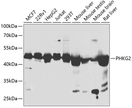 Western blot - PHKG2 Polyclonal Antibody 