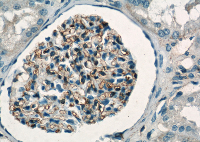 Immunohistochemistry of paraffin-embedded human kidney tissue slide using Catalog No:111417(HLA-A Antibody) at dilution of 1:50 (under 40x lens)
