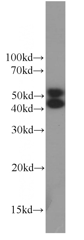 HeLa cells were subjected to SDS PAGE followed by western blot with Catalog No:107357(JNK Antibody) at dilution of 1:1000