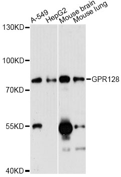 Western blot - GPR128 Polyclonal Antibody 
