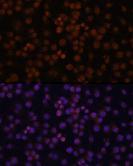 Immunofluorescence - NFKBIZ Polyclonal Antibody 