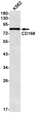Western blot detection of CD168 in K562 cell lysates using CD168 Rabbit mAb(1:1000 diluted).Predicted band size:84kDa.Observed band size:84kDa.
