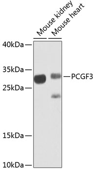 Western blot - PCGF3 Polyclonal Antibody 